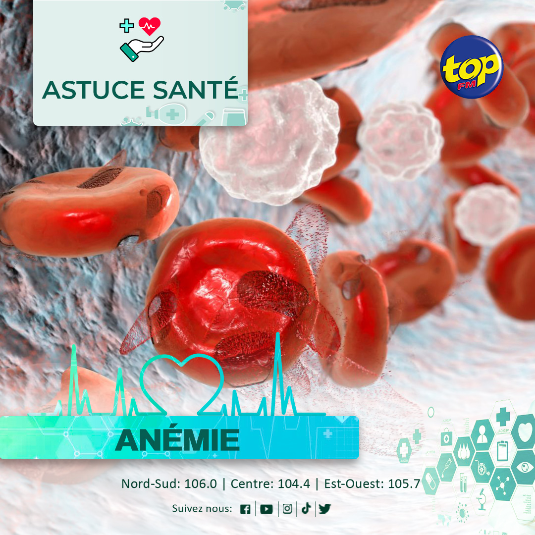 Anémie Anémie