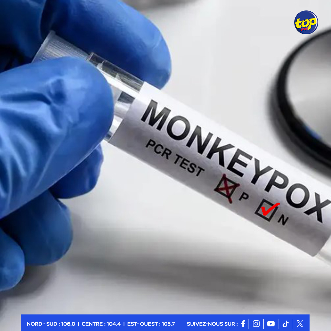 MPOX MPOX